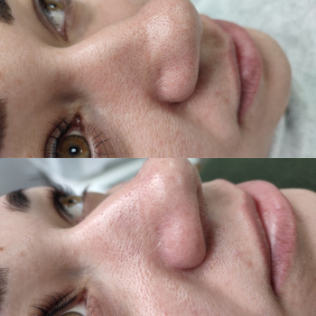 Алла Яценко, Кременчук Фото - 12