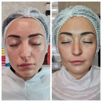 Комплексна робота з обличчям