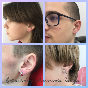 Пірсинг мочки вуха для чоловіків