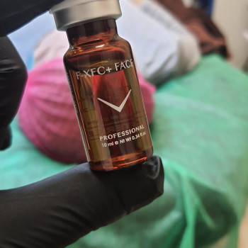 Мезотерапия