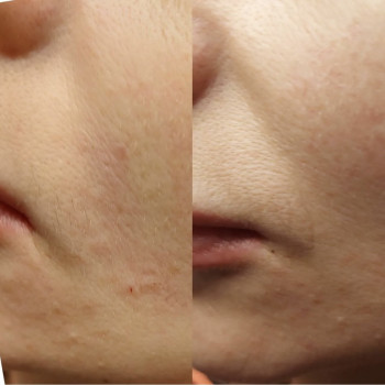 Ирина Чуевская, Львов Фото - 75