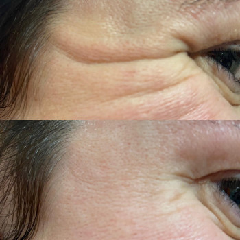 Ирина Чуевская, Львов Фото - 80