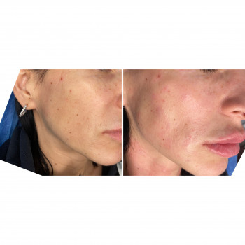 Ирина Чуевская, Львов Фото - 86