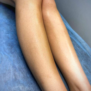 Депіляція
                    Мастер депиляции Виктория Каменское