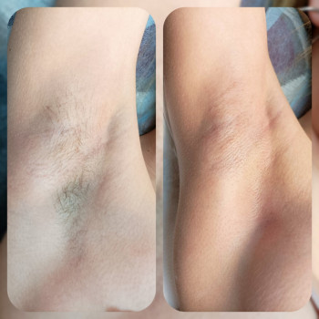 Депіляція
                    Мастер депиляции Виктория Каменское