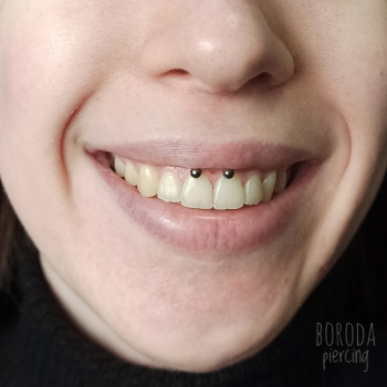 Пірсинг смайл (smile)
                    Мастер по пирсингу Сергій Киев