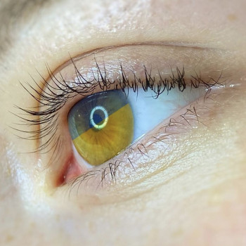 Ламінування