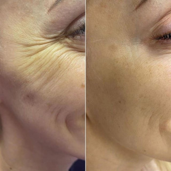 Аніта Сергіївна, Краматорськ Фото - 37