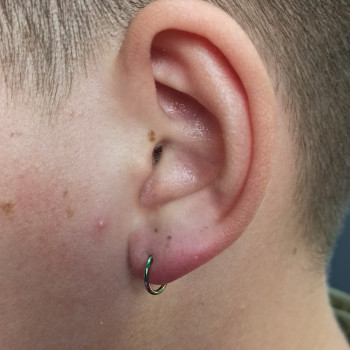 Пірсинг мочки
                    Мастер по пирсингу Сергій Киев