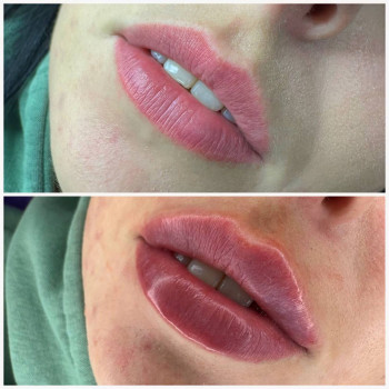 Наталія Книженко, Київ Фото - 3