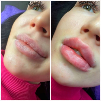 Наталія Книженко, Київ Фото - 4