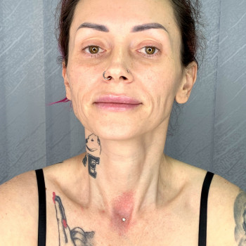 Мікродермал в яремній ямці. Пірсинг на шиї