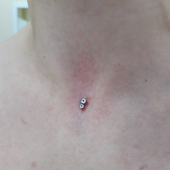 Мікродермал