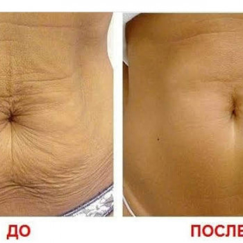 Гідромассаж
                    Косметолог Елена Київ