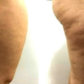 Аліна Рахуба, Святопетровское Фото - 34