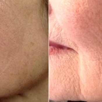 Аліна Рахуба, Святопетровское Фото - 33