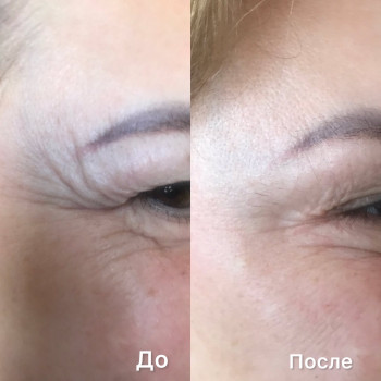 Натали Ткаченко, Киев Фото - 46