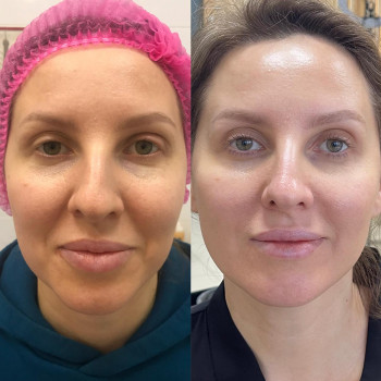 Натали Ткаченко, Киев Фото - 47