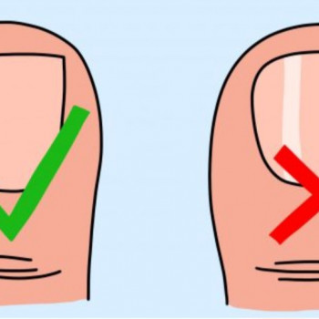 Як правильно зрізати ніготь на нозі
 
 
 
 
 