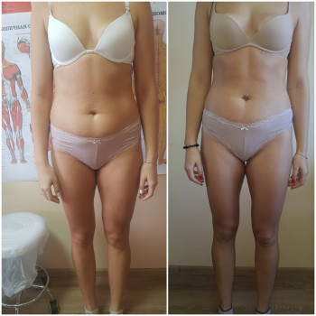 Наталя Кудряшова, Чернівці Фото - 30