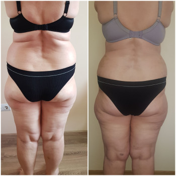 Наталя Кудряшова, Чернівці Фото - 23