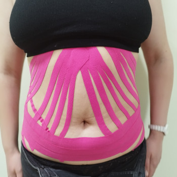 Тейпування
                    Масажист Алена Ірпінь