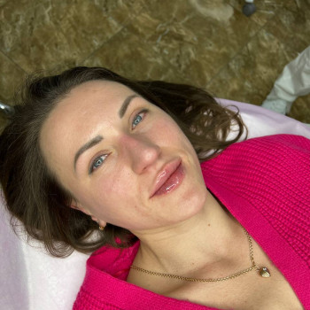 Увеличение губ
                    Косметолог Екатерина Киев