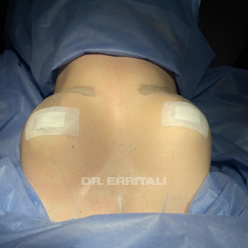 Абдель Эрритали, Київ Фото - 46