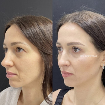 Абдель Эрритали, Київ Фото - 50