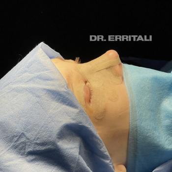 Абдель Эрритали, Київ Фото - 51