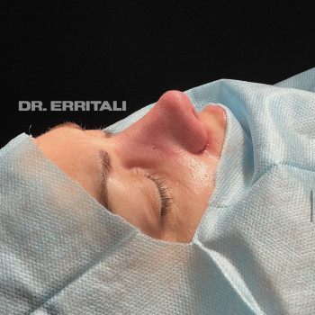 Абдель Эрритали, Київ Фото - 52