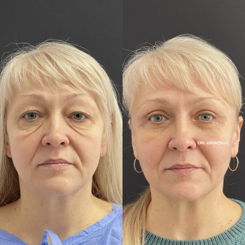 Абдель Эрритали, Харків Фото - 5