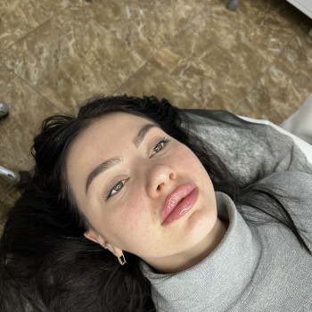 Увеличение губ
                    Косметолог Екатерина Киев