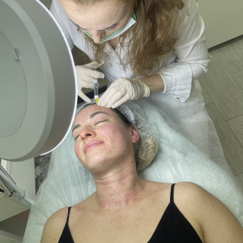 Биоревитализация
                    Косметолог Екатерина Київ