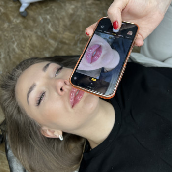 Увеличение губ
                    Косметолог Екатерина Киев