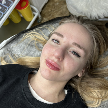 Увеличение губ
                    Косметолог Екатерина Киев