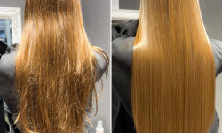 Біксіпластія Салон красоты KERATIN PLATFORMA Киев