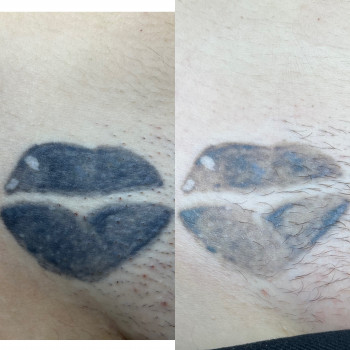 Аня Лукач, Ужгород Фото - 15