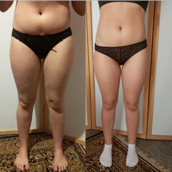 Антицелюлітний масаж
                    СПА-салон INSAY Харків