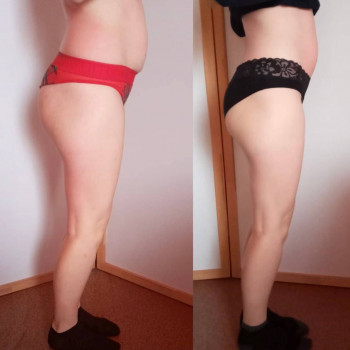 Антицелюлітний масаж
                    СПА-салон INSAY Харків