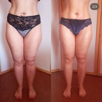 Антицелюлітний масаж
                    СПА-салон INSAY Харків