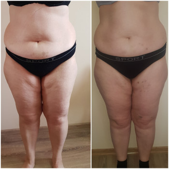 Наталя Кудряшова, Чернівці Фото - 34