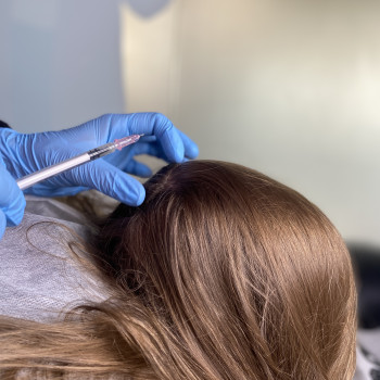 Мезотерапія волосся
                    Косметолог-инъекционист Тетяна Бровары