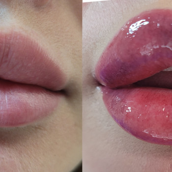 Елена Рогожа, Дніпро Фото - 9