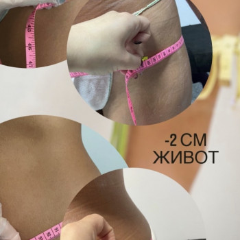 Body Arithmetic, Черкаси Фото - 5