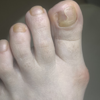 Олена Борисюк, Овруч Фото - 6