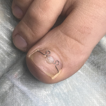 Олена Борисюк, Овруч Фото - 7