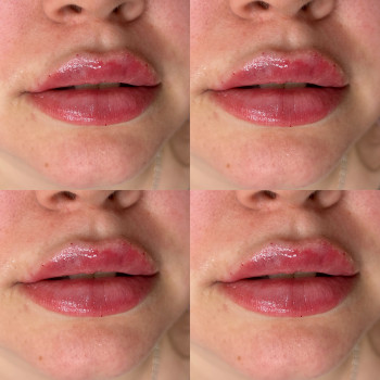 Фото из портфолио косметолога Олена Поліщук (Одесса)