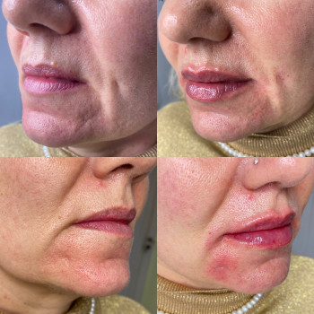 Фото из портфолио косметолога Олена Поліщук (Одесса)