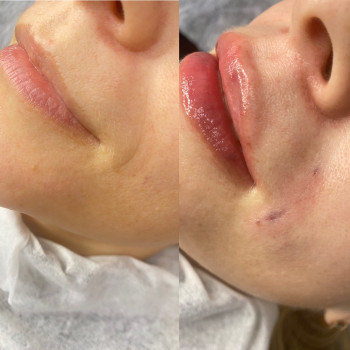 Фото из портфолио косметолога Олена Поліщук (Одесса)